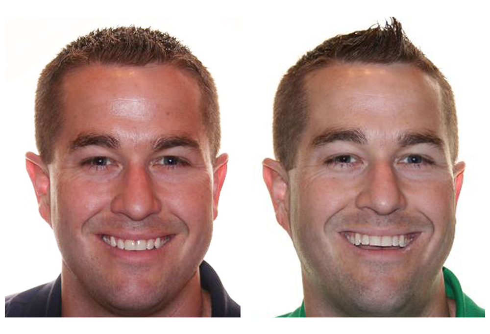 Boohaker Family   Cosmetic Dentistry