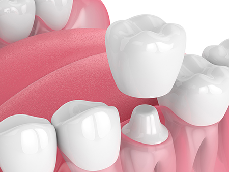 Boohaker Family   Cosmetic Dentistry
